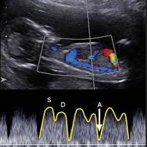 Doppler Ultrasound in Obstetrics & Gynecology Doc