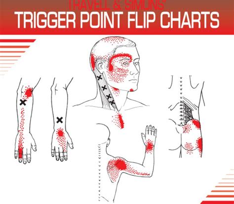 Download Travell and Simons  Trigger Point Flip Charts PDF Kindle Editon