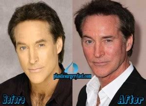 Drake Hogestyn Weight Loss: The Incredible Transformation of a Hollywood Star