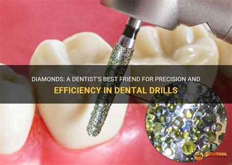 Drills3D Studio: Revolutionizing the Dental Industry with Precision and Efficiency