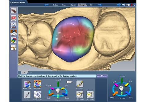 Drills3D Studio: The Ultimate 3D CAD/CAM Solution for Dental Professionals