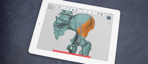 Drills3D Studio: The Ultimate 3D Printing Design Tool for Orthopedic Surgeons