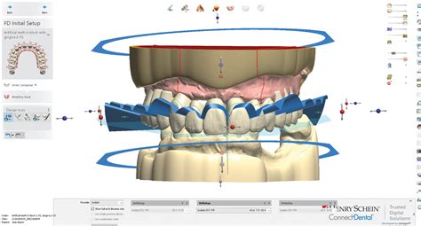 Drills3D Studio: Unleashing Precision and Efficacy in Dental Digital Design