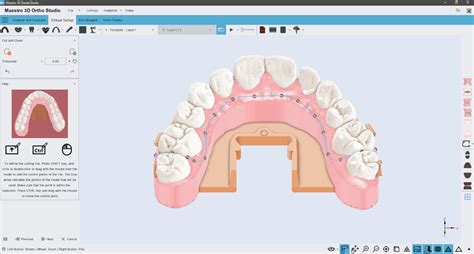 Drills3D Studio: Unlocking the Potential of 3D Dental Treatment Planning