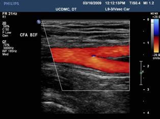 Duplex Scanning in Vascular Disorders Doc