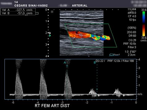 Duplex and Color Doppler Imaging of the Venous System Kindle Editon