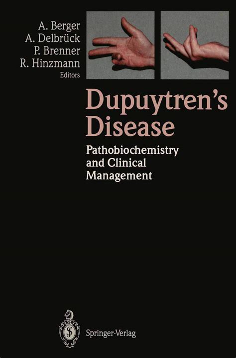 Dupuytren's Disease Pathobiochemistry and Clinical Management Kindle Editon