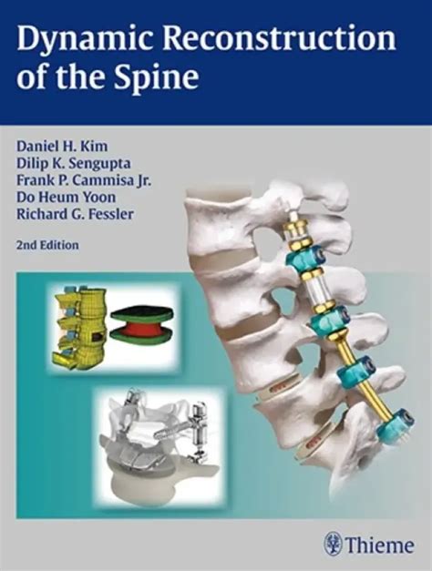 Dynamic Reconstruction of the Spine Kindle Editon