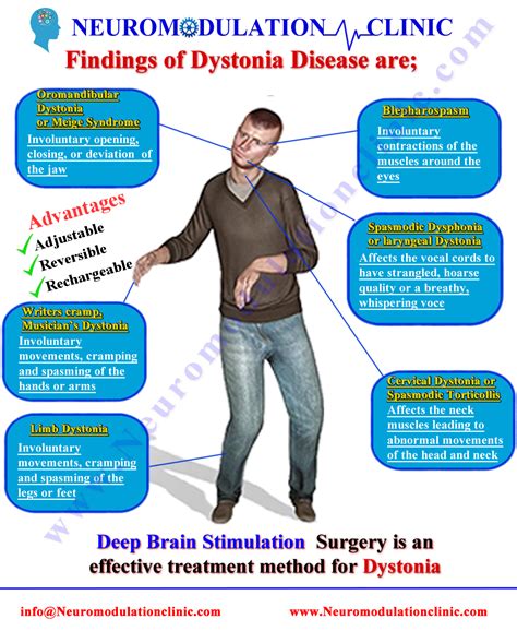 Dystonia 3 Epub