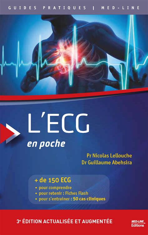 ECG DE POCHE Ebook Doc