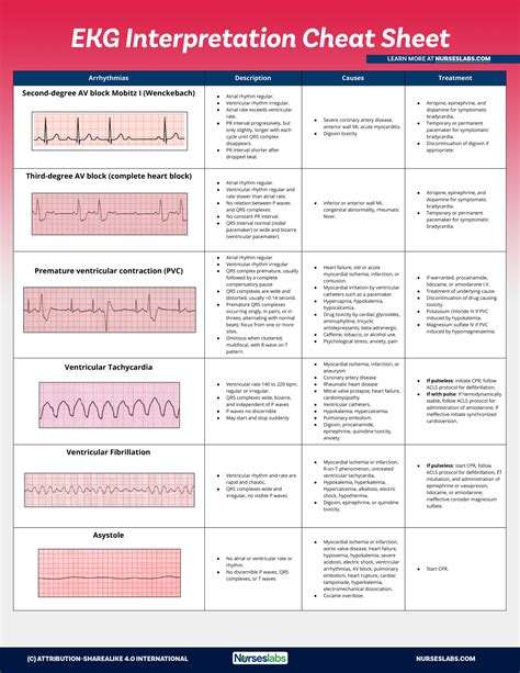 Ecg Interpretation Chart