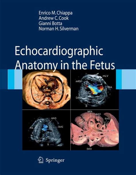 Echocardiographic Anatomy in the Fetus 2nd Printing Epub