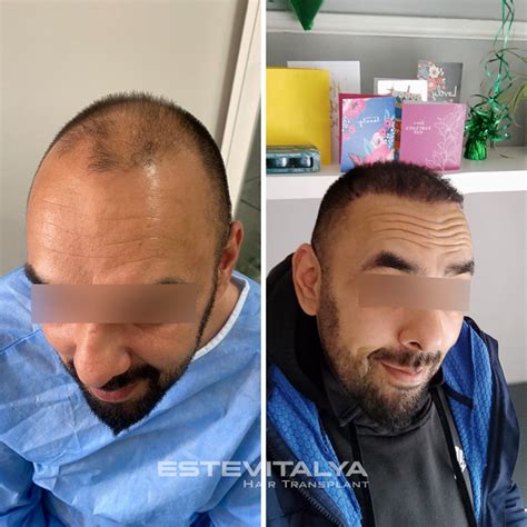 Eine Oase für Haartransformationen