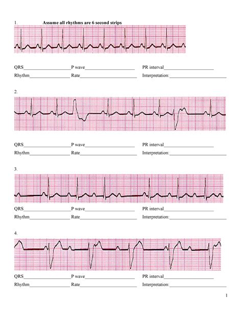 Ekg Practice Strips With Answers Reader