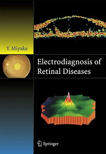 Electrodiagnosis of Retinal Disease Corrected 2nd Printing Epub