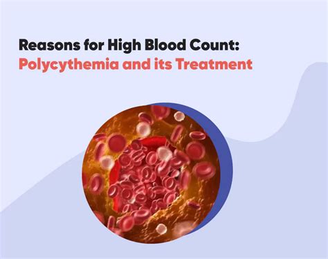 Elevated Red Blood Count (Polycythemia): 10,000+ Everything You Need to Know