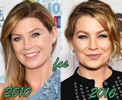 Ellen Pompeo's Plastic Surgery: A Complete Guide