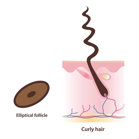 Elliptical Hair Follicles: