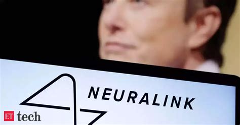 Elon Musk's $1,000,000,000 Gamble on Neuralink