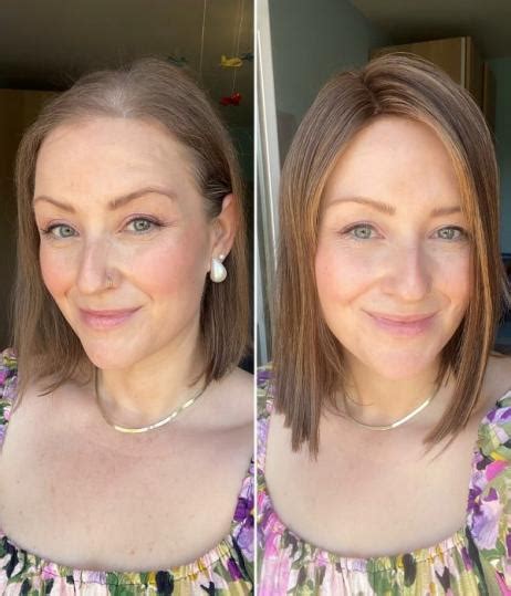 Embrace Your Confidence: Hair Toppers for Short Hair - A Journey to Revitalized Locks