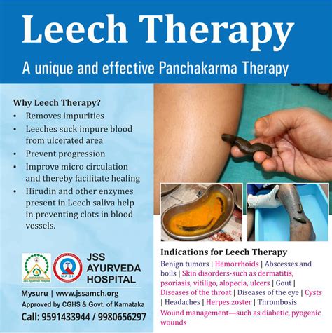 Embrace the Power of Leech Therapy for a Healthier, More Fulfilling Life