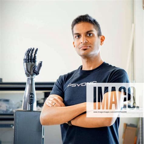 Embracing the Edge: Sinclair Limbus Company's Revolutionary Advancements in Bionic Limb Technology