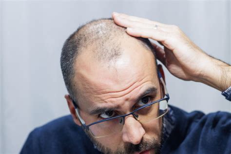 Embracing the Silver Grace: A Comprehensive Guide to Grey Toupees