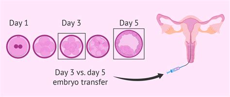 Embryo Transfer and Implantation