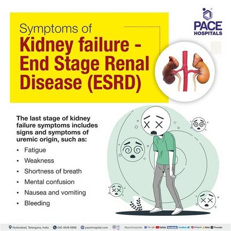 End Stage Renal Disease in Children Epub