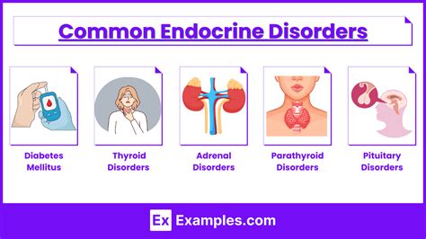 Endocrine Problems Oxford General Practice Library Kindle Editon