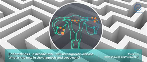 Endometriosis the Enigmatic Disease PDF