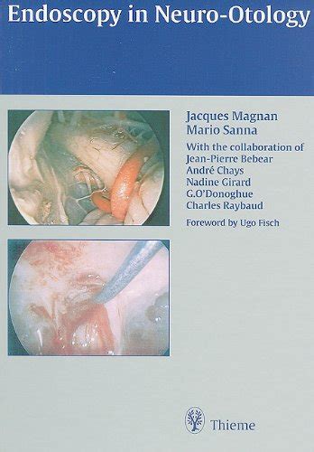 Endoscopy in Neuro-Otology 1st Edition Kindle Editon