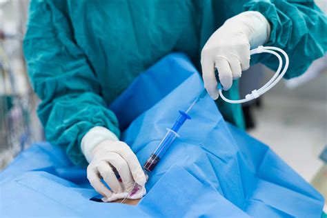 Endovascular Surgery PDF