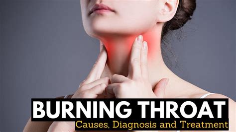 Enduring the Agony: A Comprehensive Guide to Daily Throat Burns