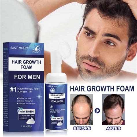 Enhances hair volume and density: