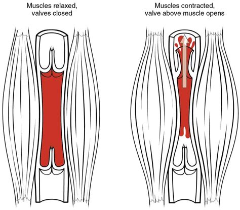 Enhancing Venous Return: