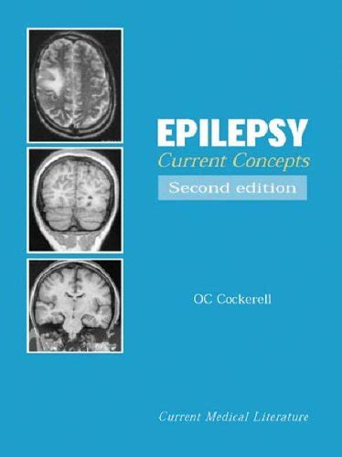 Epilepsy Current Concepts Kindle Editon