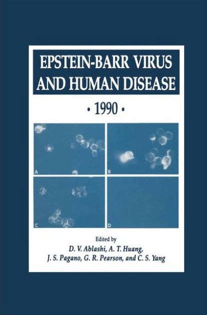 Epstein-Barr Virus and Human Disease  1990 1st Edition Kindle Editon