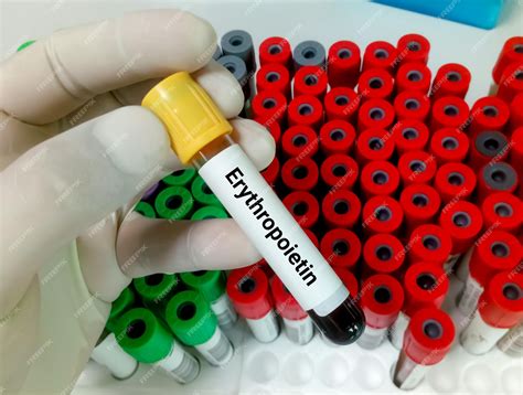 Eritropoetina: O Hormônio Essencial para a Produção de Hemácias