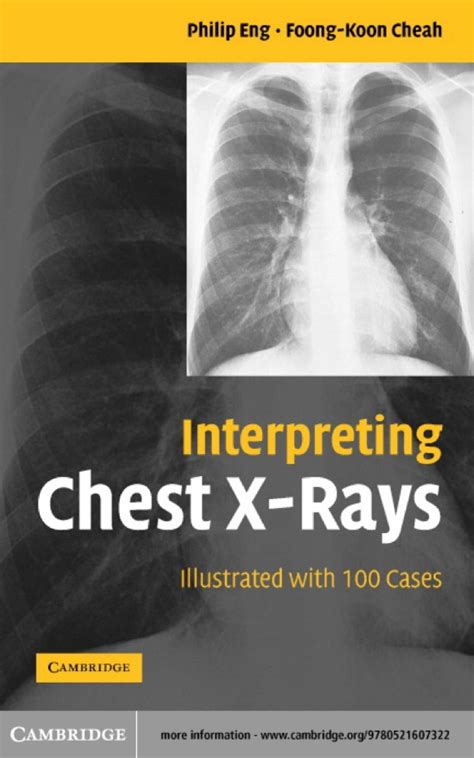 Errors in Chest Radiography 1st Edition Doc