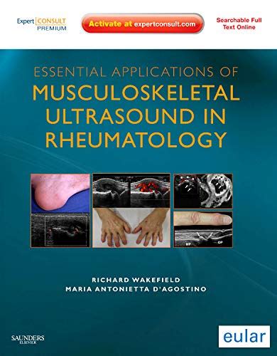 Essential Applications of Musculoskeletal Ultrasound in Rheumatology Expert Consult Premium Edition Doc