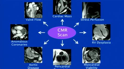 Essentials of Cardiac Radiology and Imaging Epub
