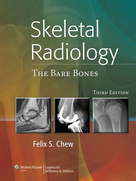 Essentials of Skeletal Radiology Ebook Ebook Reader