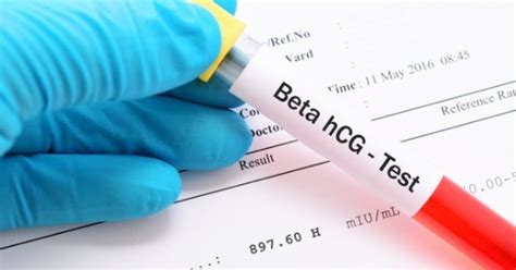 Exame Beta HCG Positivo: Guia Completo para Entender seus Resultados