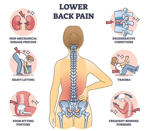 Exploring the Phenomena of Back Pain: Causes, Risk Factors, and Management Strategies