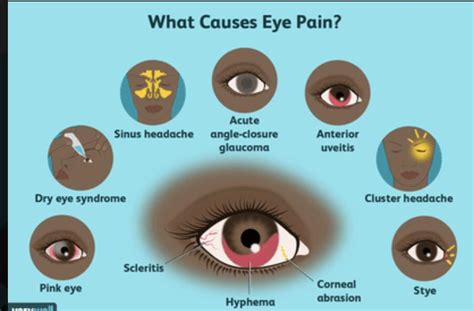 Eyeballs Hurt to Move: Causes, Treatments, and Solutions