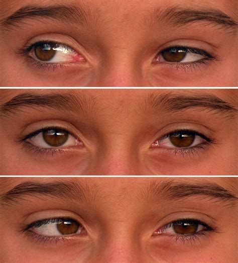 Eyes Not Aligned: A Comprehensive Guide to a Bizarre Internet Phenomenon