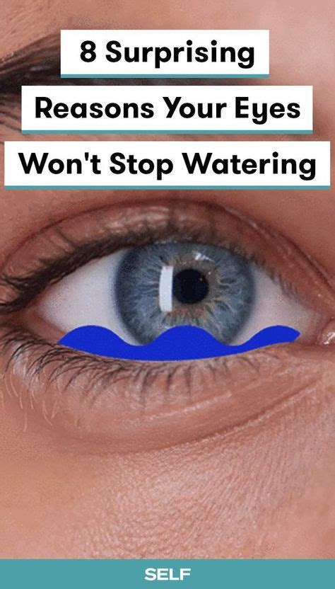 Eyes Won't Stop Watering: 10,000+ Words on Causes, Symptoms, and Solutions