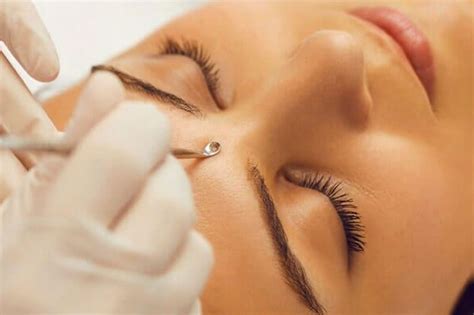 Facial Extractions Near Me: Your Ultimate Guide to Clear and Radiant Skin