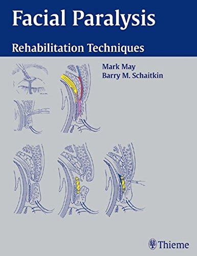Facial Paralysis Rehabilitation Techniques 1st Edition PDF